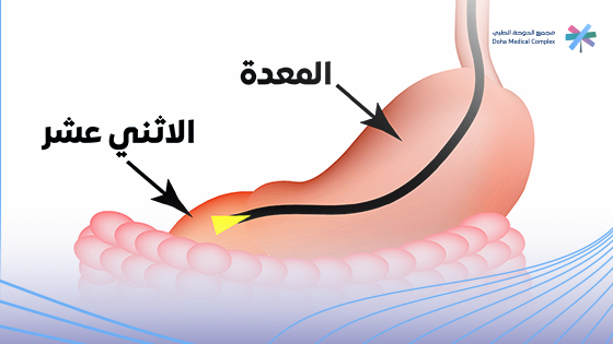 أنواع-مناظير-الجهاز-الهضمي أنواع-مناظير-الجهاز-الهضمي