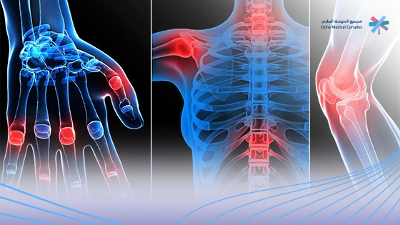 علاج-سريع-لالتهاب-المفاصل علاج-سريع-لالتهاب-المفاصل