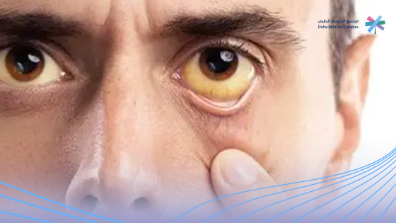 أعراض-خروج-السموم-من-الكبد أعراض-خروج-السموم-من-الكبد