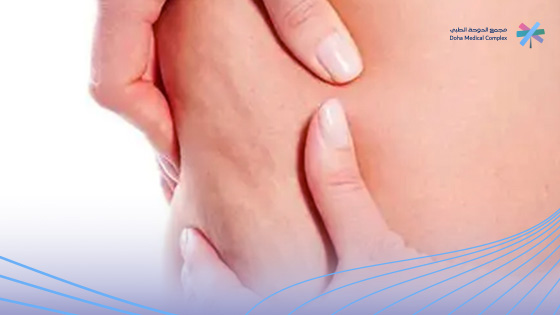 اسباب-ظهور-السيلوليت اسباب-ظهور-السيلوليت
