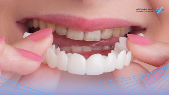 تركيب-ابتسامة-هوليود-المتحركة تركيب-ابتسامة-هوليود-المتحركة