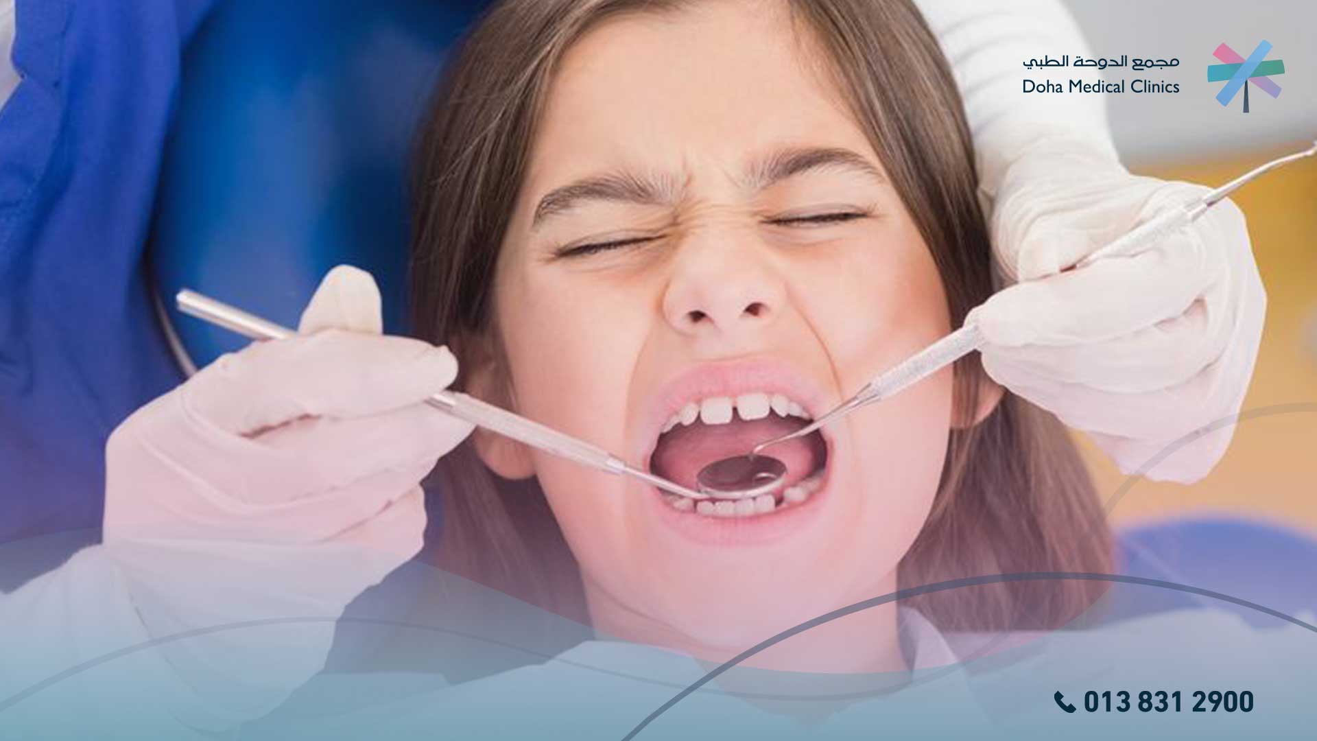 متى يجب استخراج الضرس