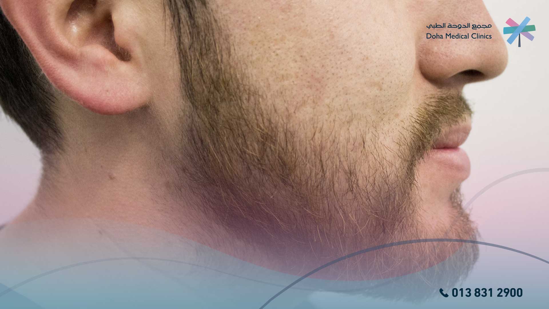 ثعلبه الذقن