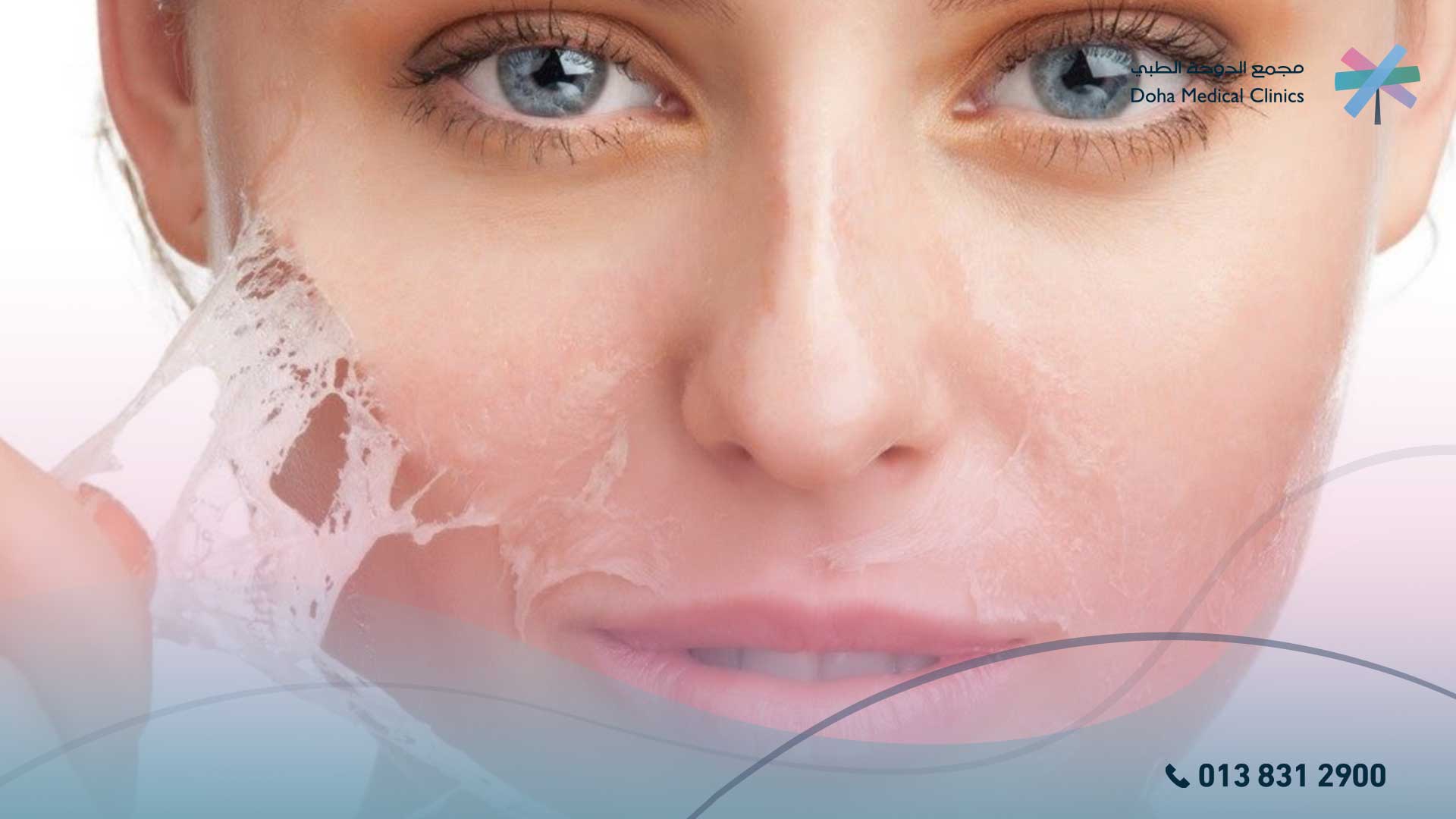 أنواع تقشير الوجه