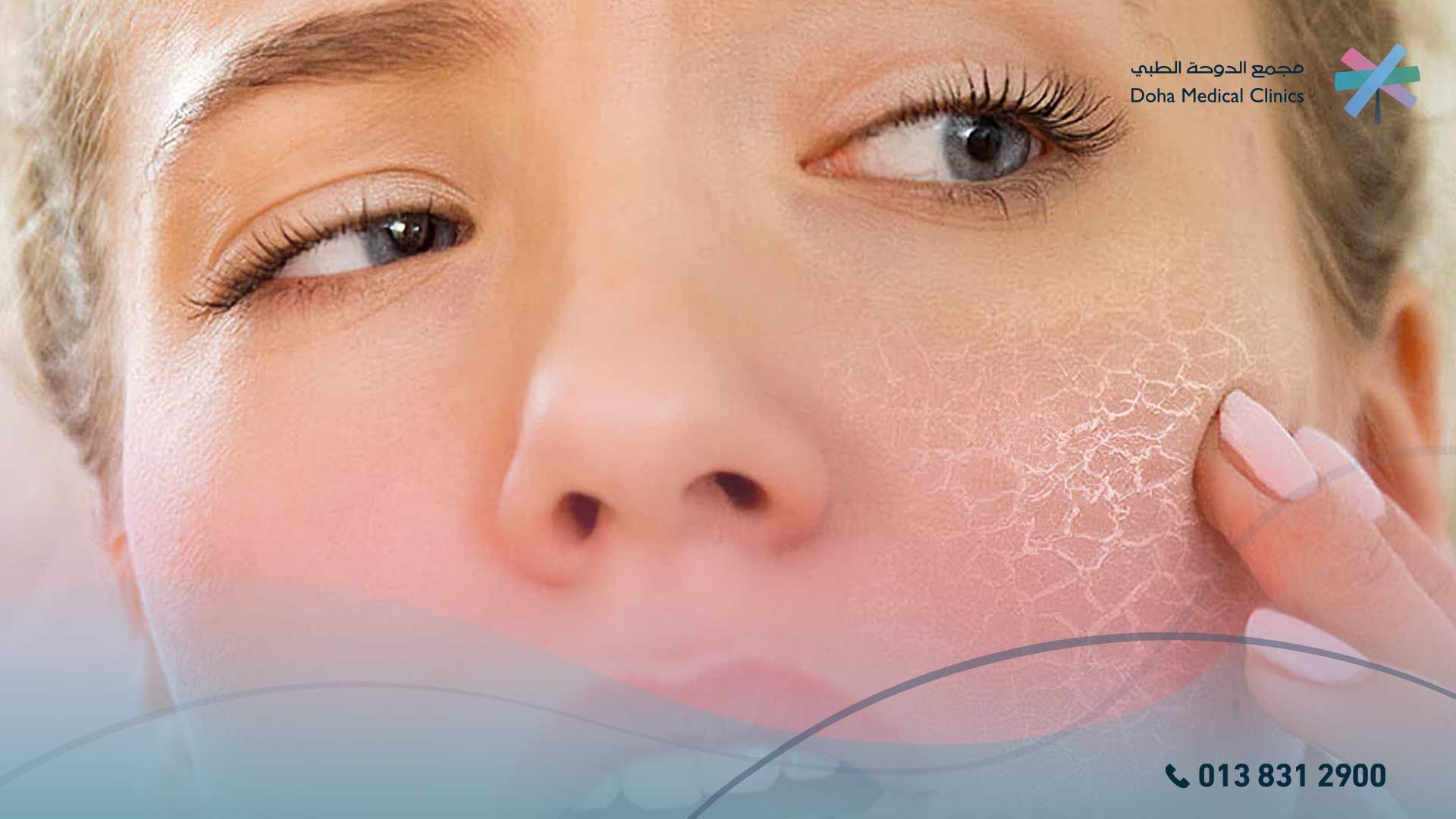 تصبغات الجلد