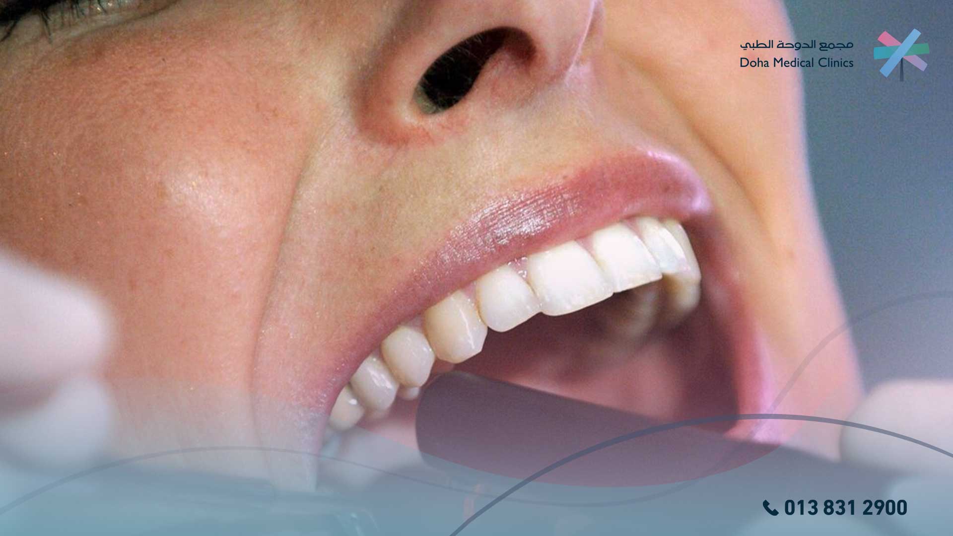 هل ضرس العقل يسبب صداع ودوخة