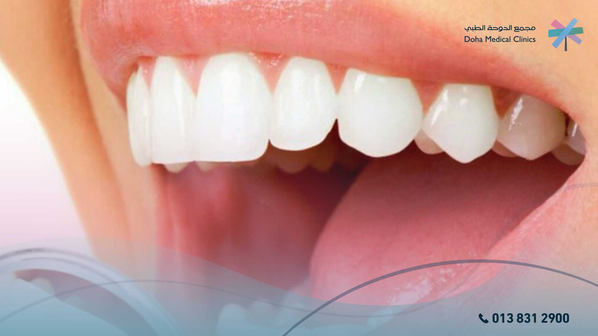 داء المبيضات الفموي