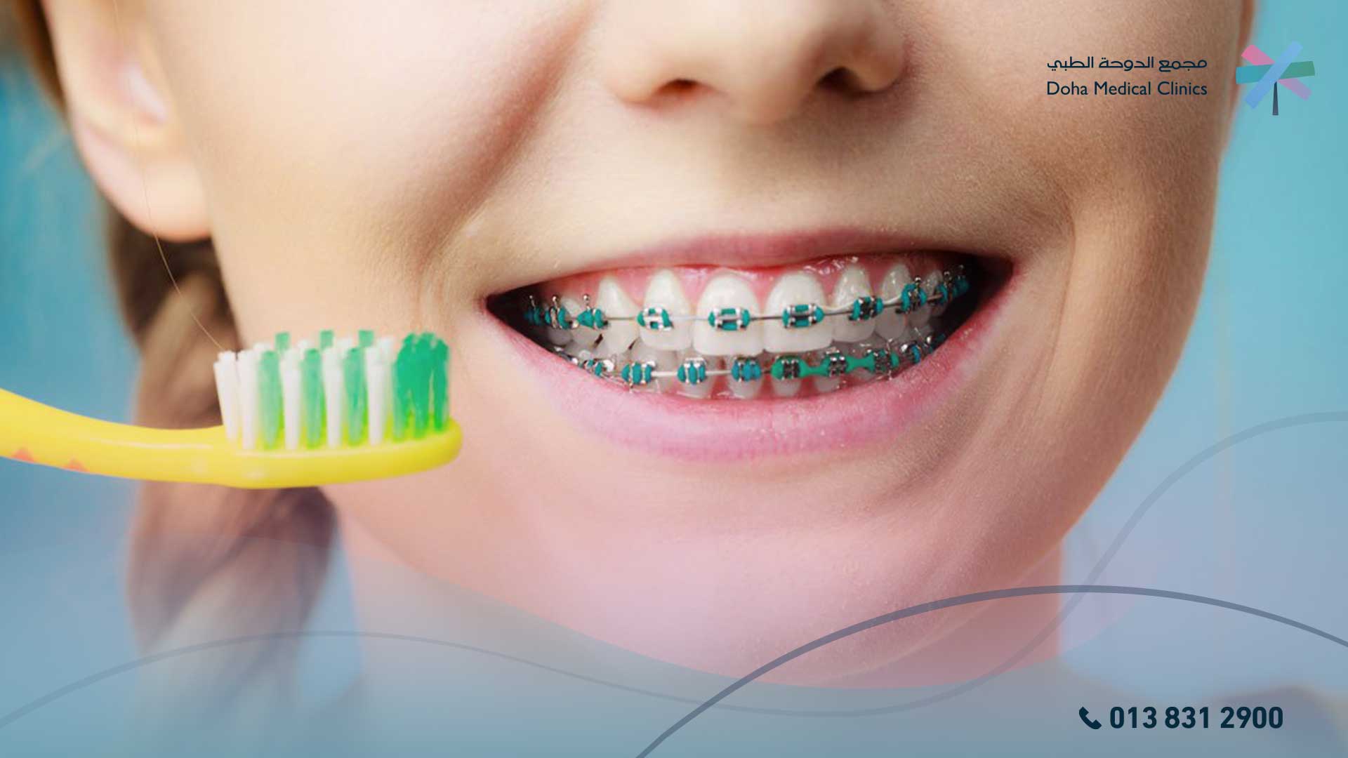 تقويم الأسنان للأطفال
