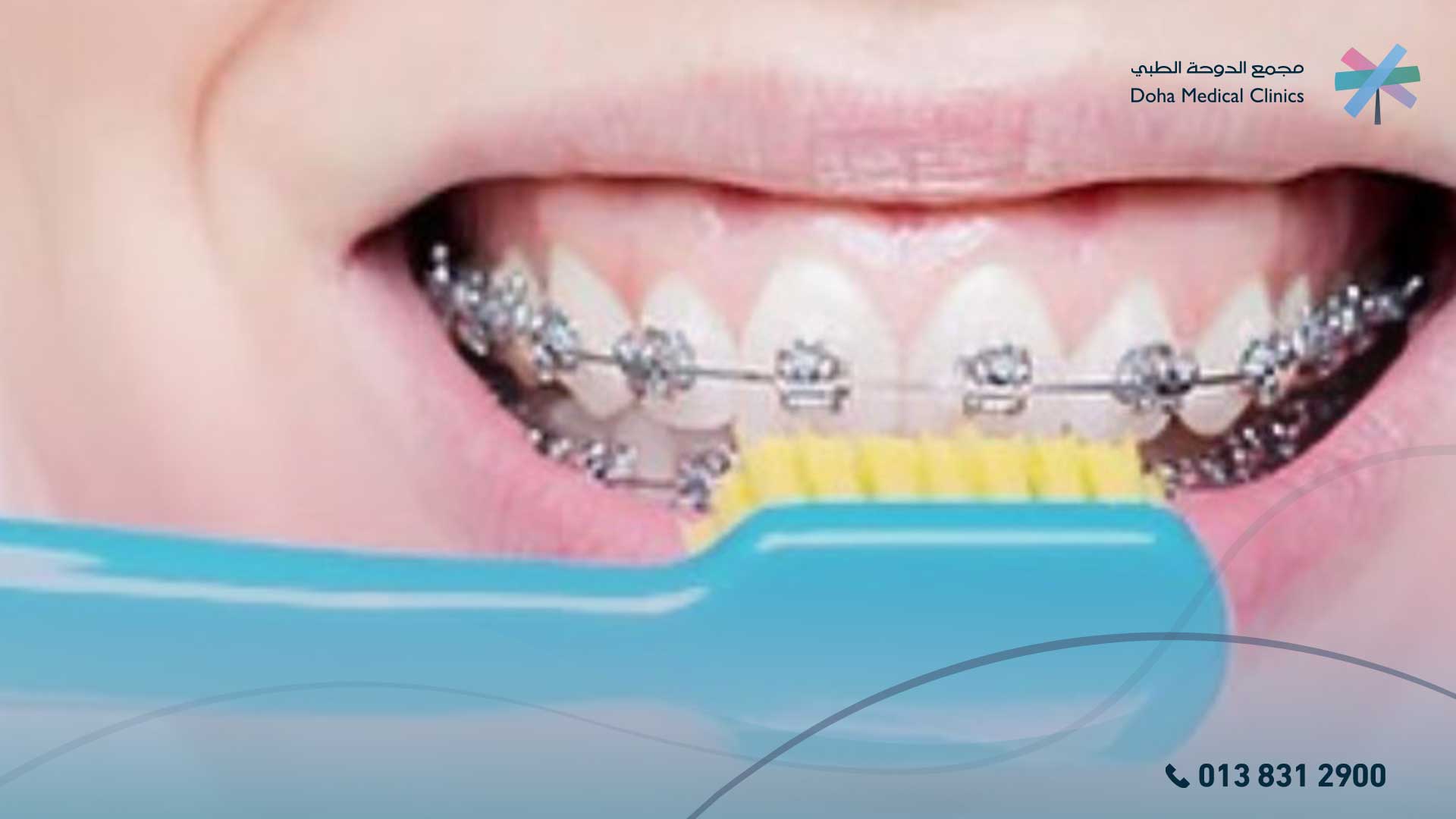 السيوم للاطفال للاسنان