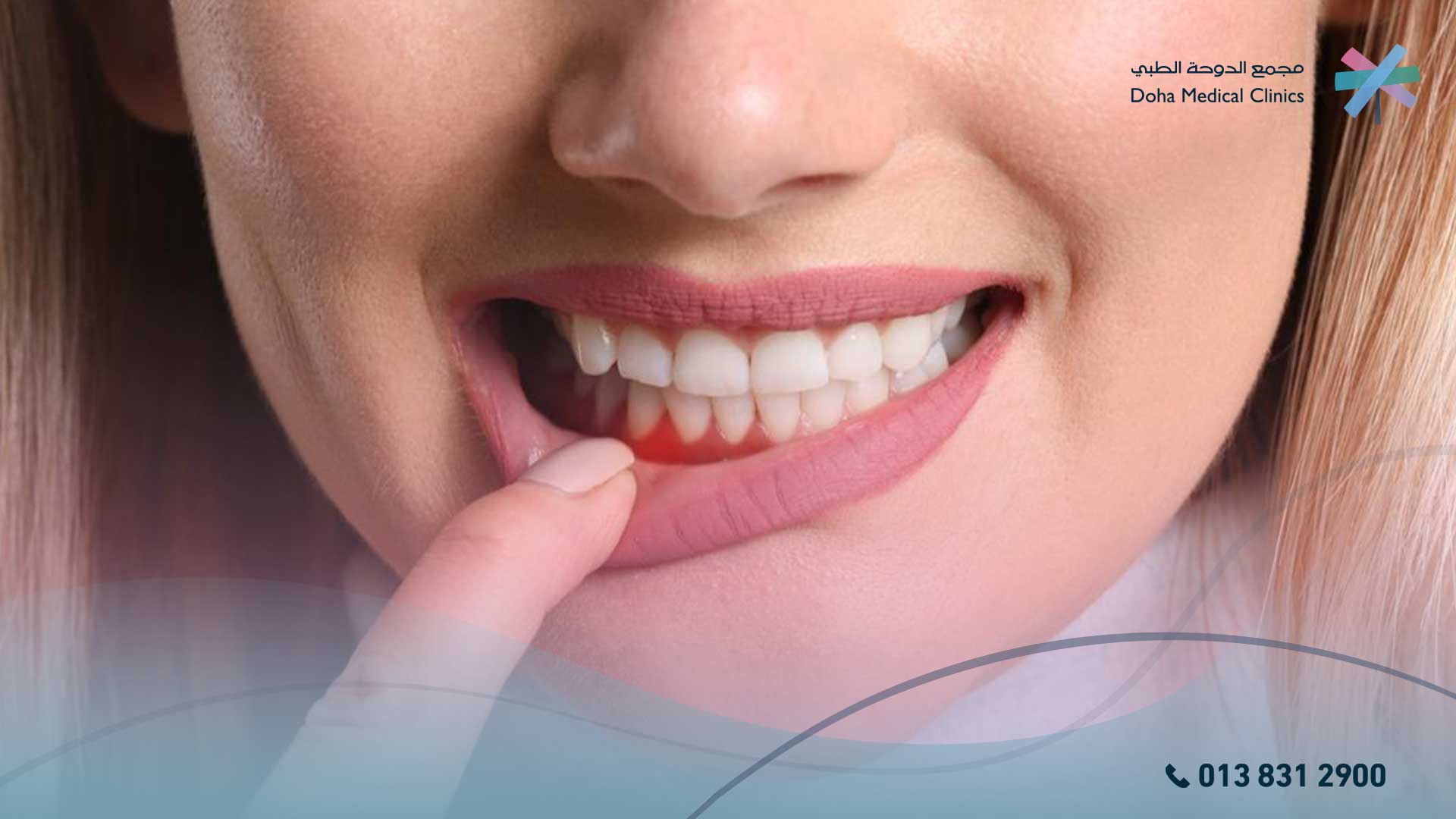 افضل دكتور لعلاج انحسار اللثة