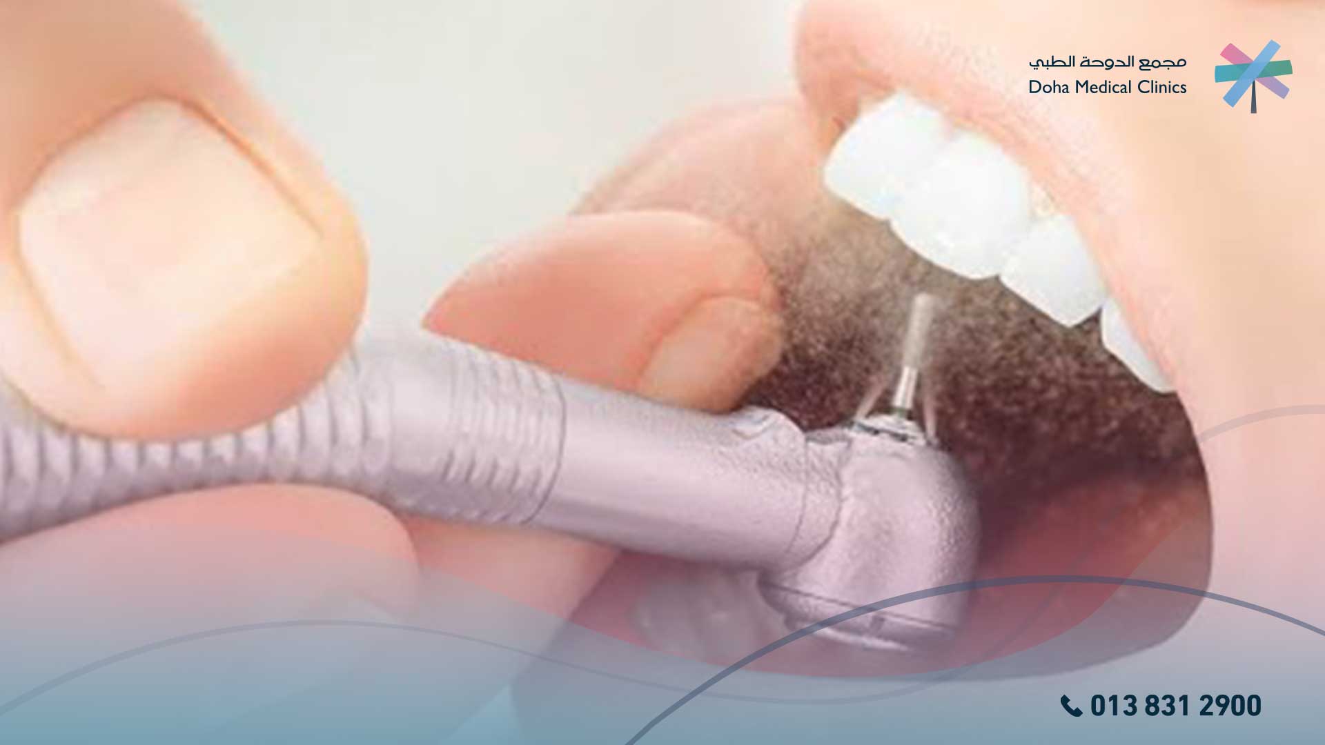 افضل 11طريقة تنظيف الأسنان من الاصفرار