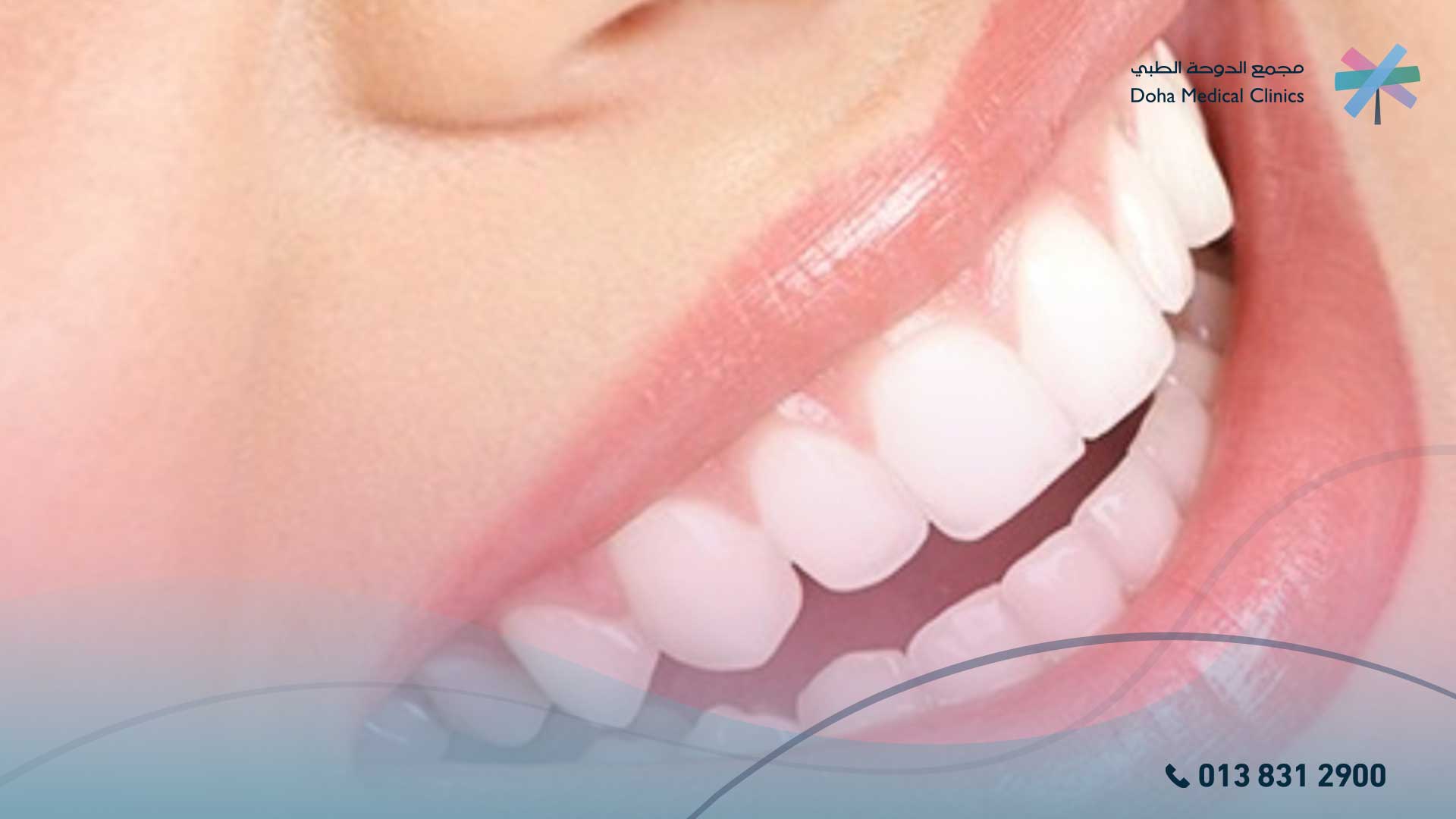 علاج حساسية الأسنان بعد التنظيف