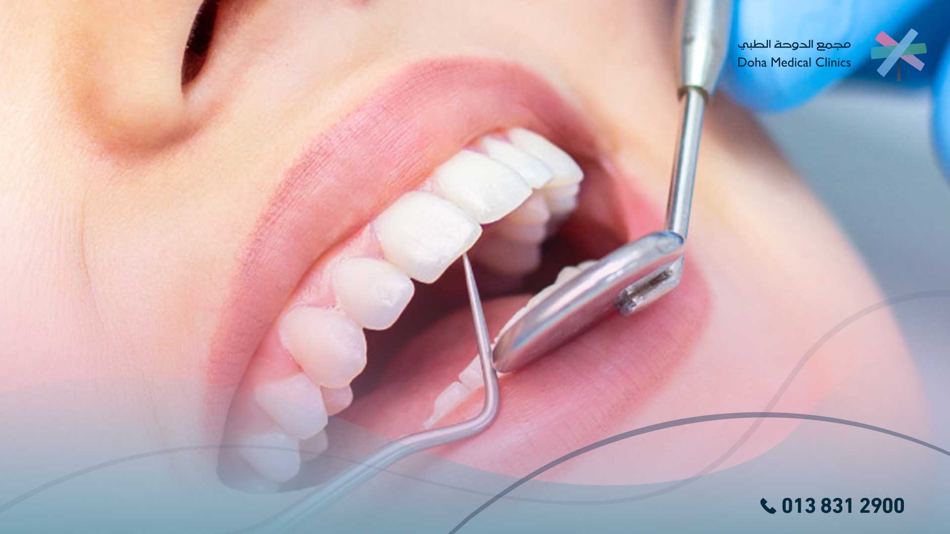 ‏علاج ألم الأسنان طبيعيا