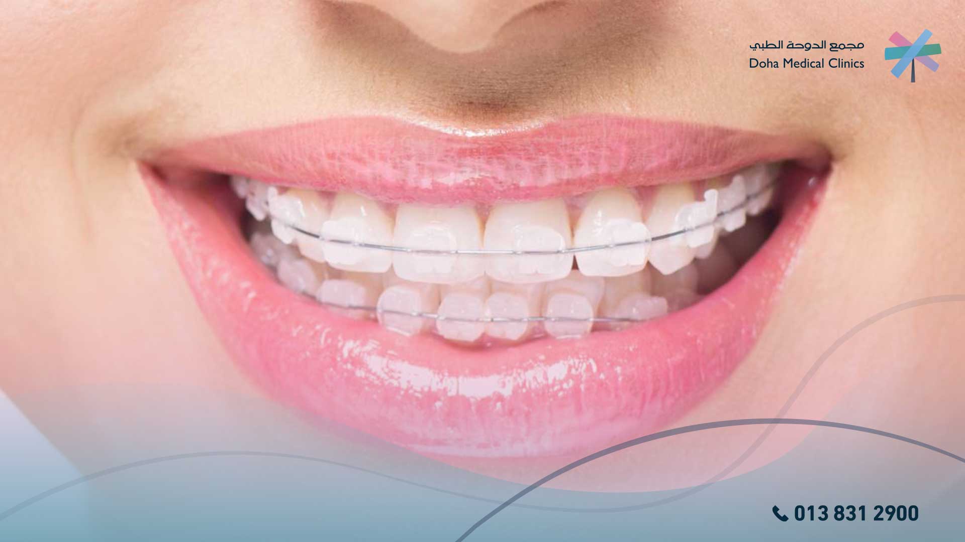 أضرار تقويم الأسنان