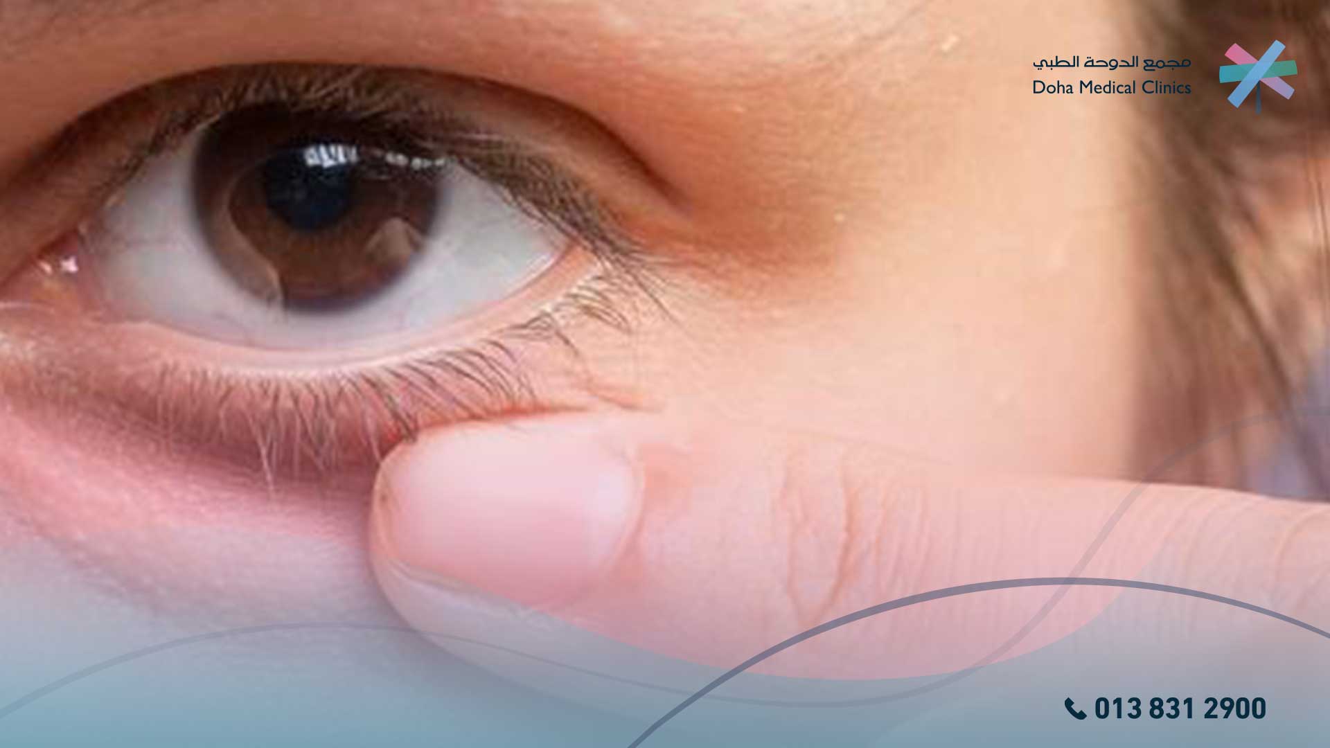 تاثير الكحل على العين