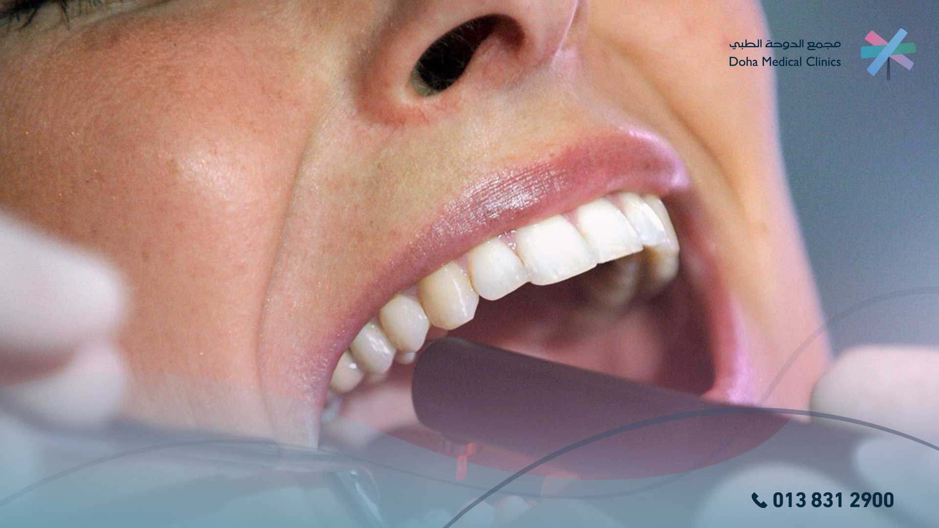معلومات عن خلع الضرس