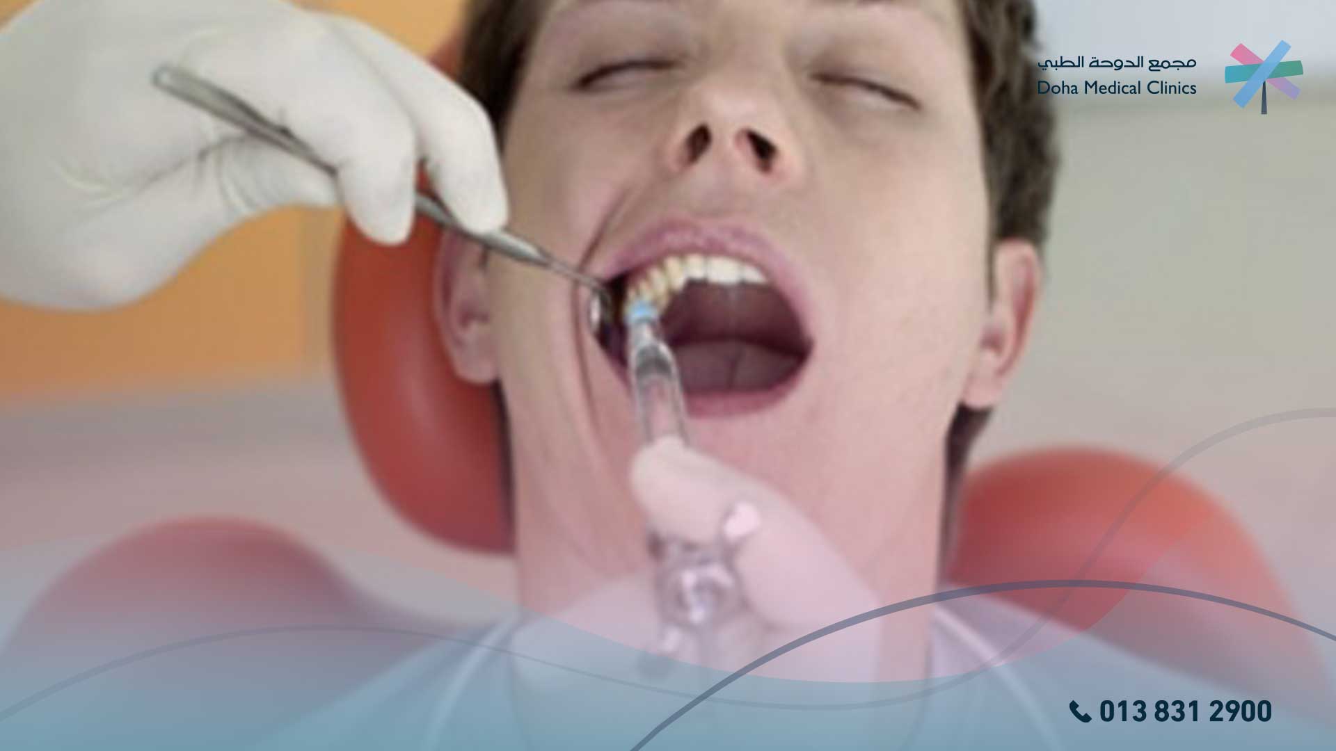 نصائح بعد خلع ضرس العقل