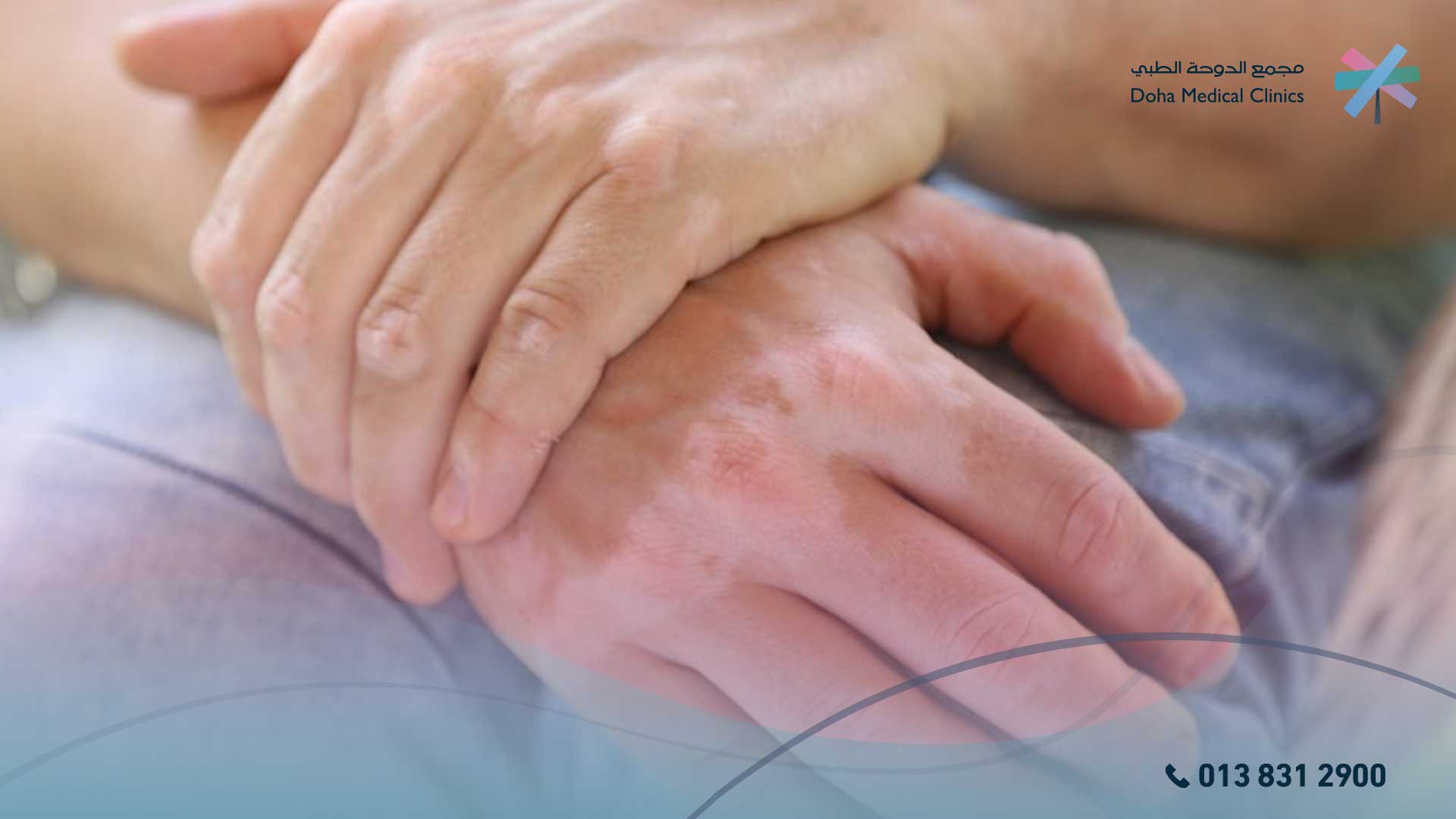 البقع البيضاء والبهاق