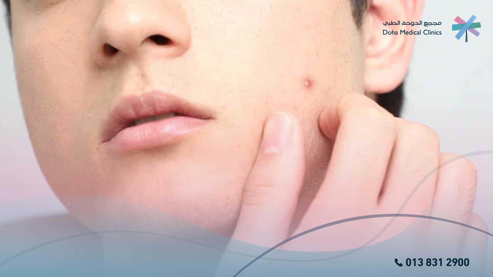 ظهور بقع سوداء على الجسم