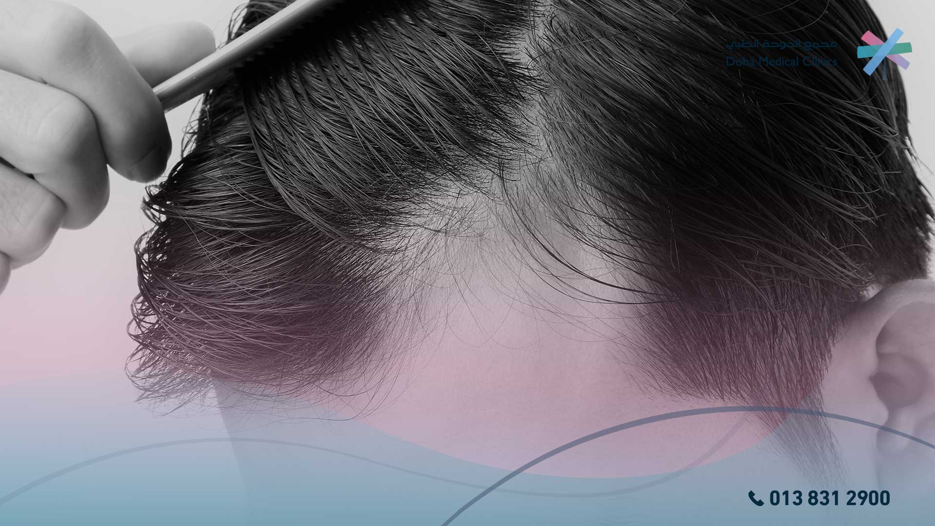 علاج تساقط الشعر