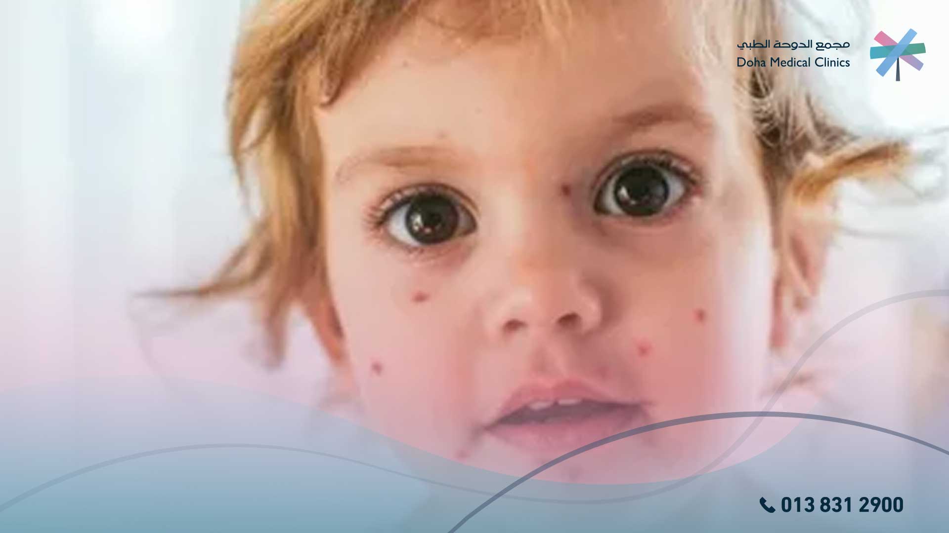 الهربس التناسلي