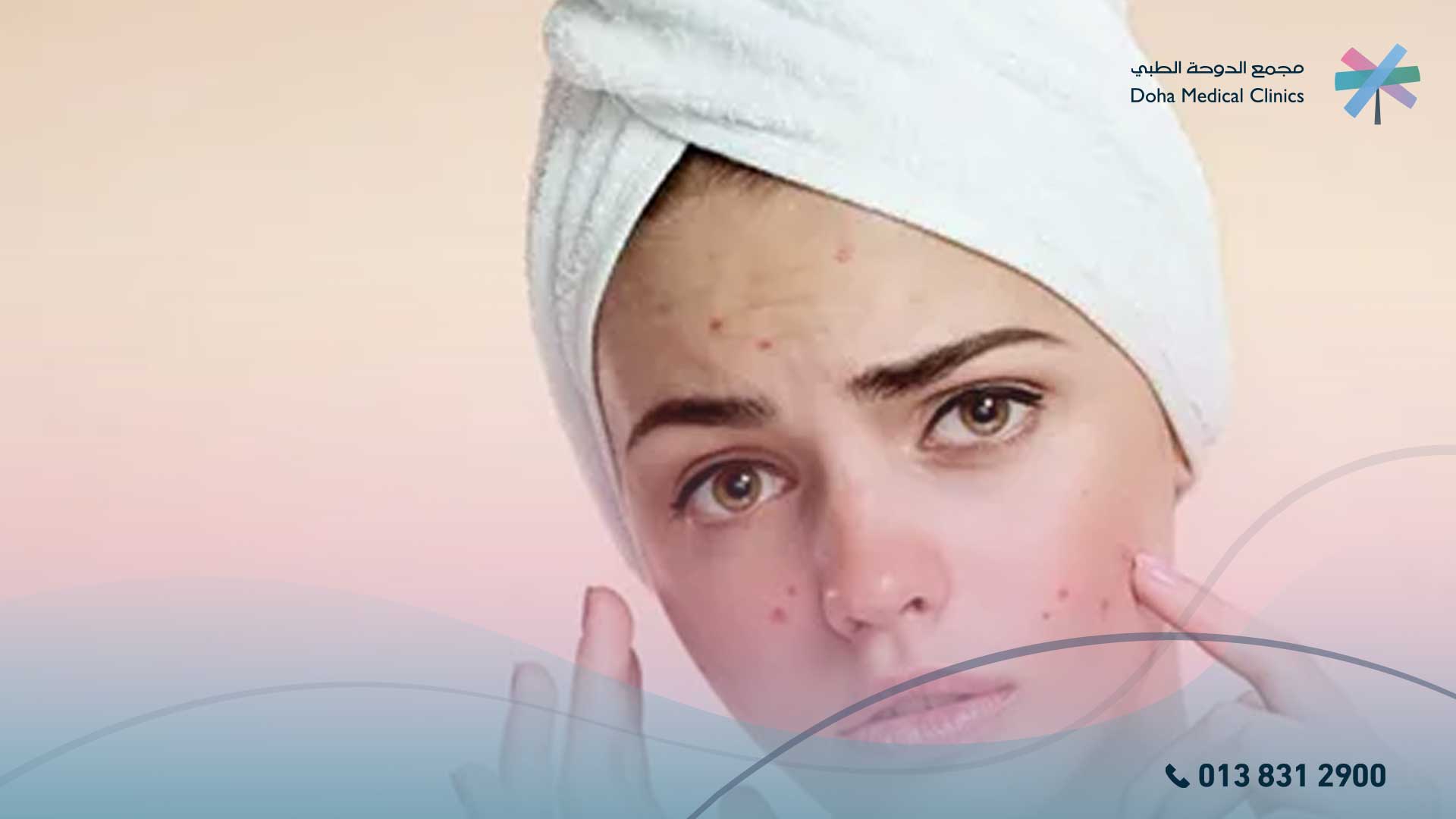أنواع حب الشباب