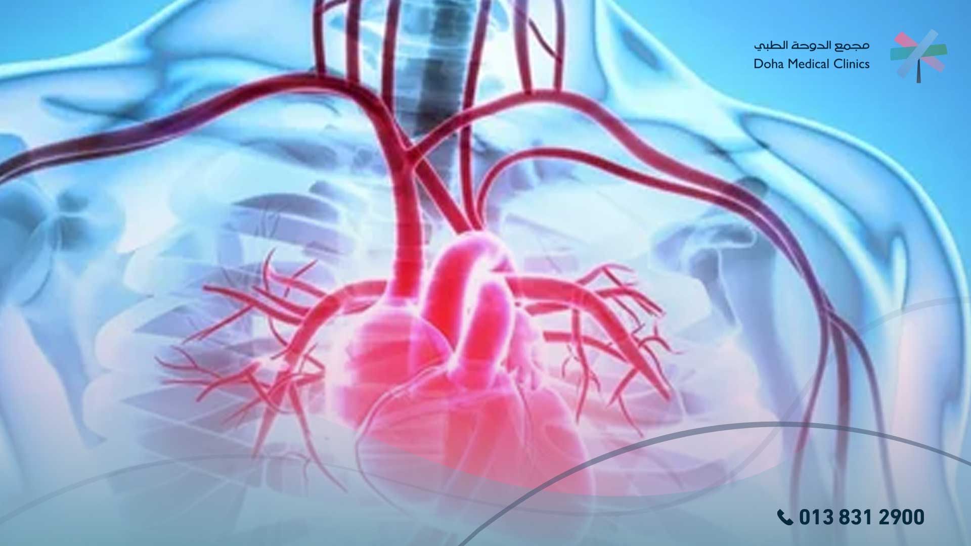 علاج متلازمة الشريان التاجي الحادة