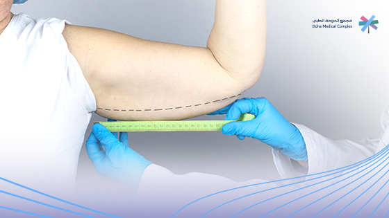 جراحة شد وتجميل الذراعين