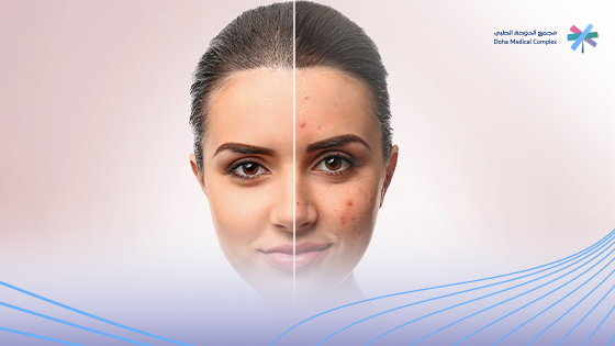 علاج ندبات الوجه
