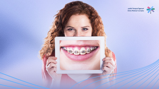 أنواع تقويم الأسنان بالصور واسعارها